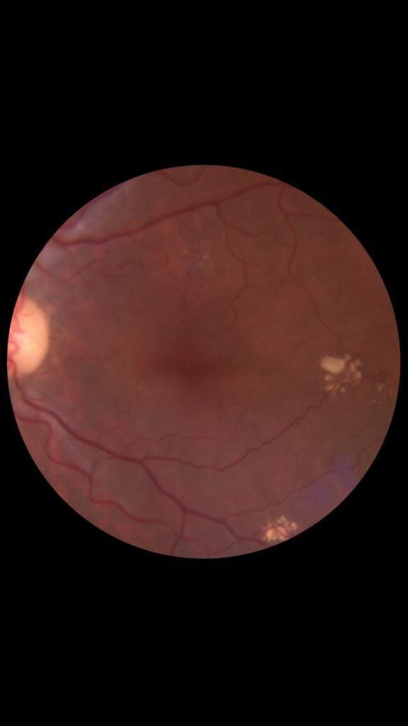 Cámara portátil de Fondo de Ojo AURORA - Imagen 2